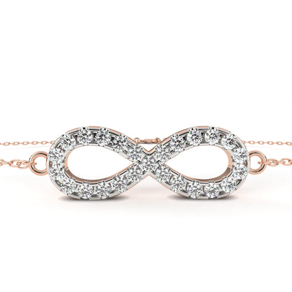 Bracelet 17